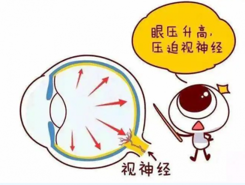 兰州爱尔韦萍院长:重视青光眼随访,防止视功能损伤(图1) height=377